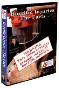 Video - Horrific Injuries - The Facts